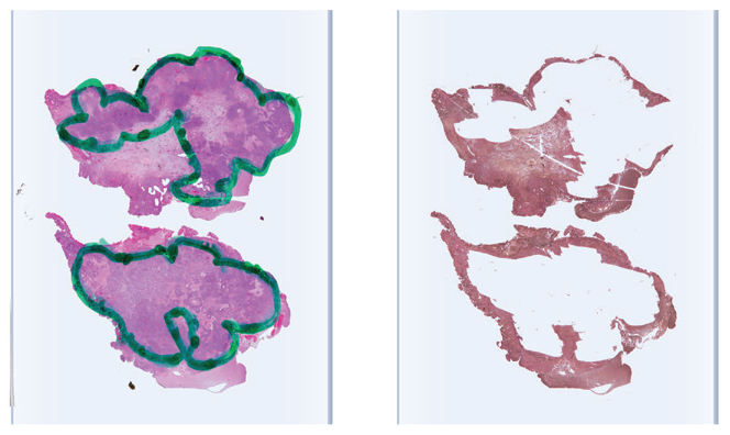 Tissue Profiling with Microdissection