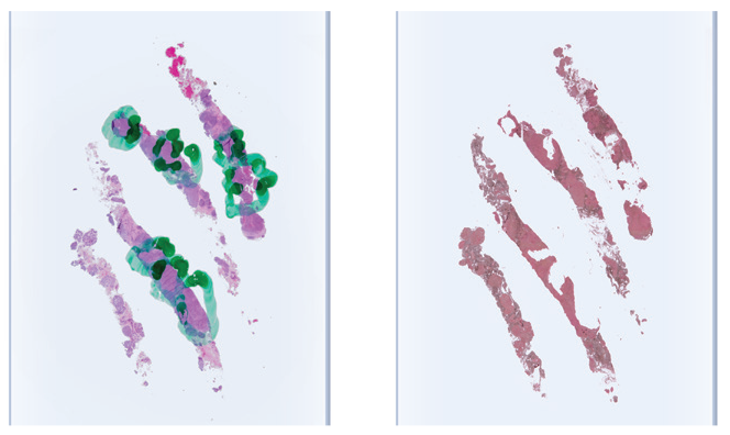 Tissue Profiling without Microdissection
