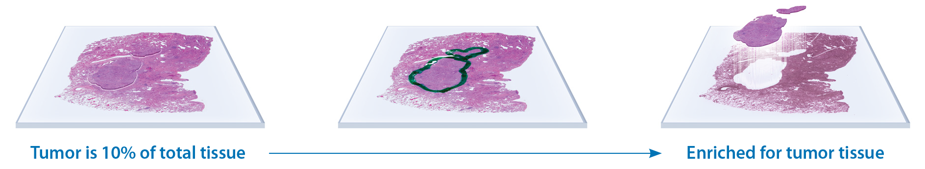 Tissue Microdissection | Tissue Profiling