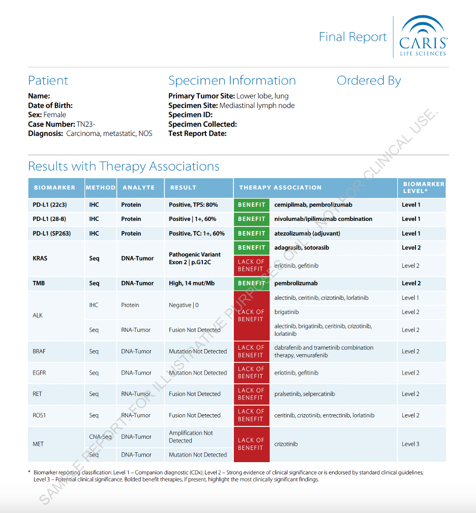Lung Sample Report